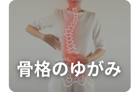 骨格の歪みイメージ