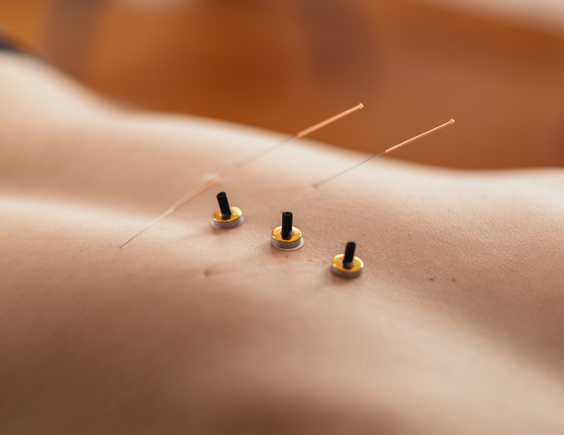 鍼灸施術のイメー２