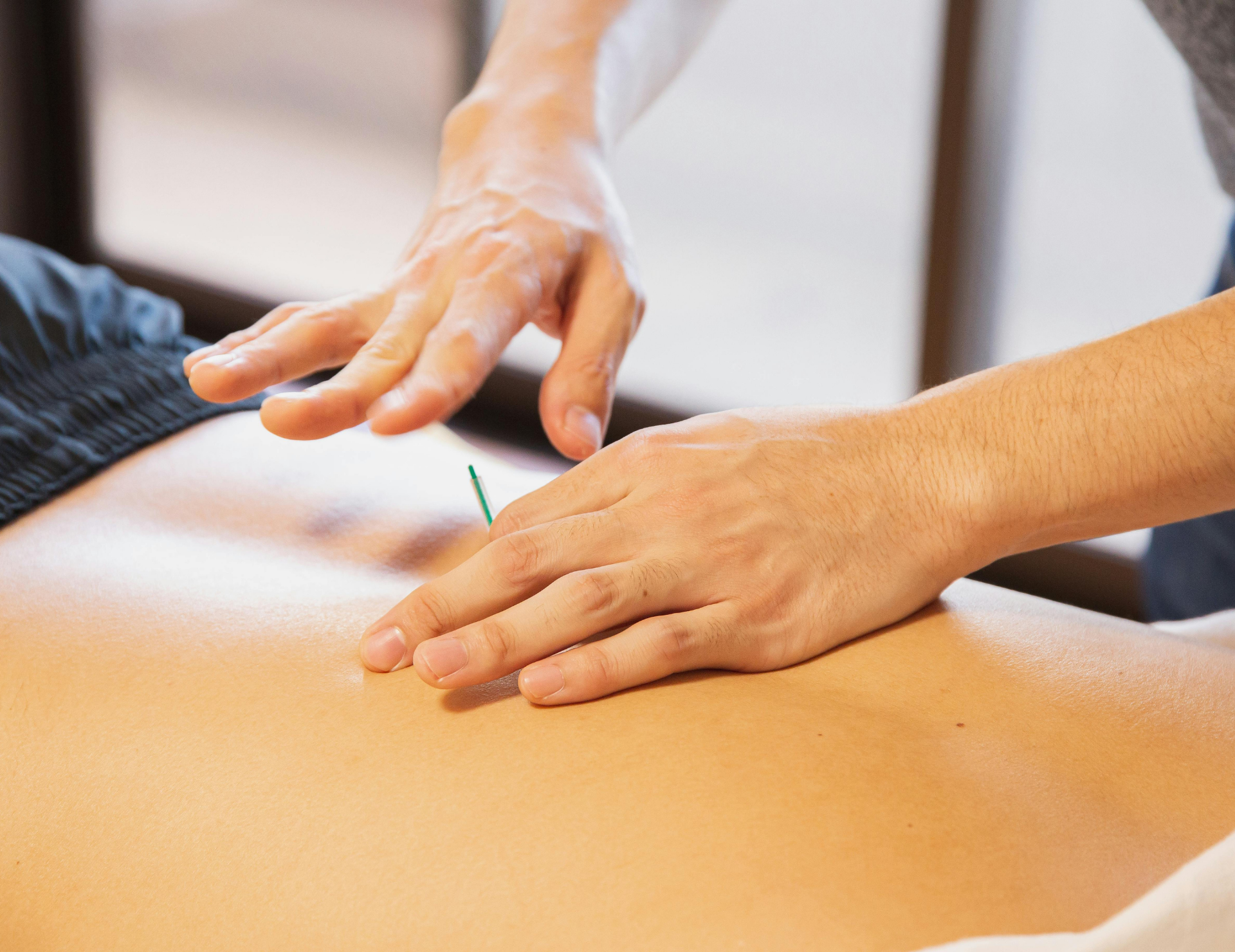 鍼灸施術のイメージ１